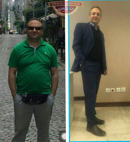 عکس های قبل و بعد از رژیم خام گیاهخواری - کاهش وزن و تناسب اندام عالی